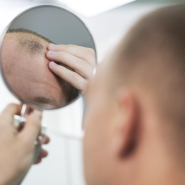 Combat Hair Loss for Long-Term Results with Customized Medical and Regenerative Treatments