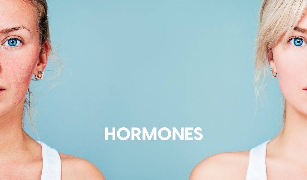 Hormones