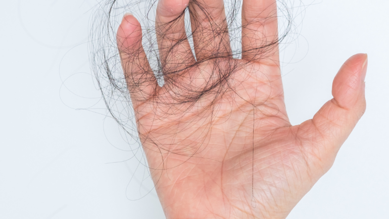 Functional Remedies of Hair Loss